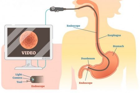 endoscopie-bucuresti-cotroceni